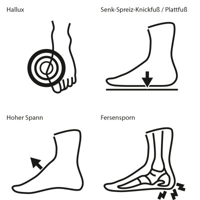 Anspruchsvolle Fußformen und -Fehlstellungen  - Passende Schuhe bei Fußfehlstellungen – Orthopädie Peters